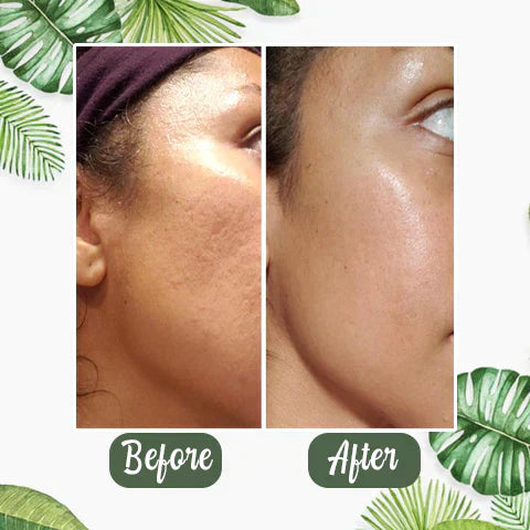GreenCleanse Stick – Effortlessly Purify Your Skin & Reveal Your Natural Radiance - 50% OFF